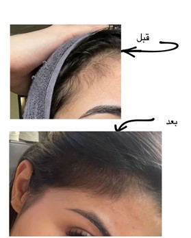 روغن تخم کدو سامانا اویل