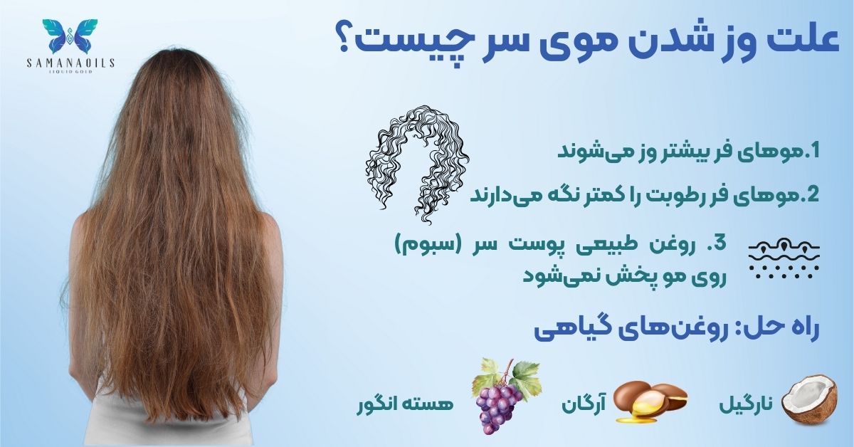 علت وز شدن موی سر چیست؟