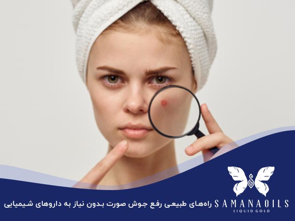 راههای طبیعی رفع جوش صورت