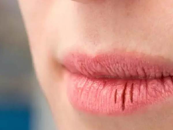 روغن تراپی لب های خشک