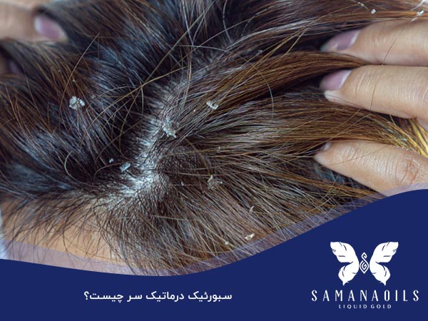 سبورتیک درماتیک سر چیست