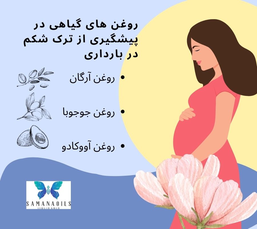 روغن های گیاهی در پیشگیری از ترک شکم در بارداری 