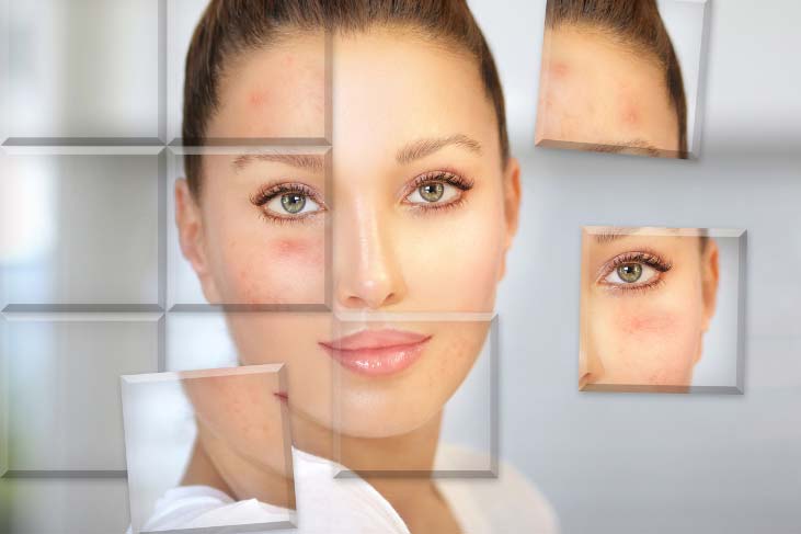 از بین بردن جای زخم