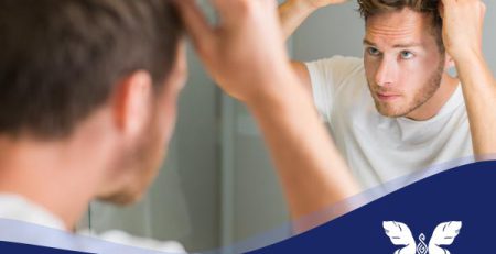 درمان چربی کف سر