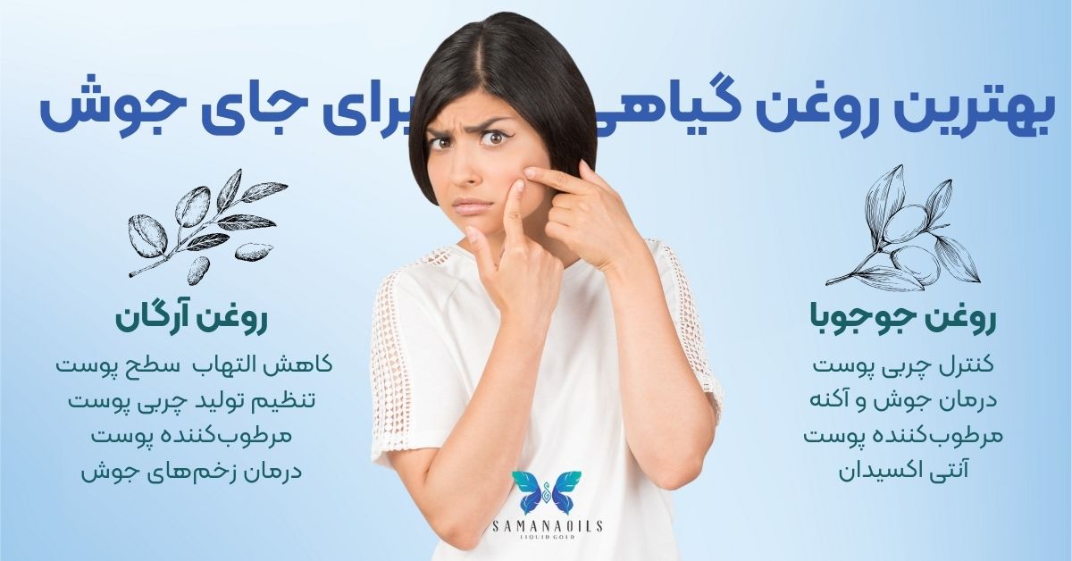معرفی 2 تا از بهترین روغن گیاهی برای ذرمان جای جوش