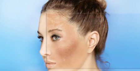 روغن جوانه گندم برای سفیدی پوست