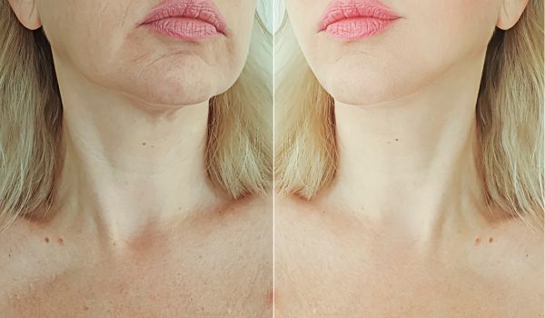 خرید روغن جوجوبا