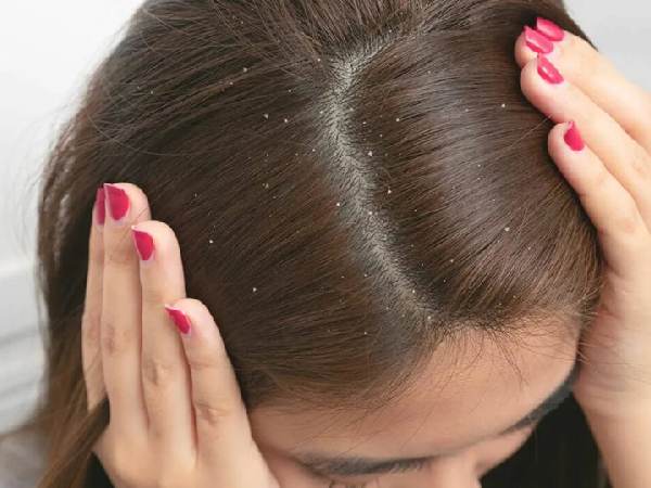 عکس غلاف مو