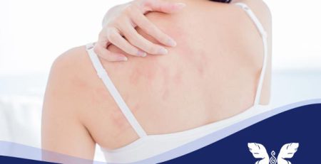 کمبود کدام ویتامین باعث خارش بدن میشود؟