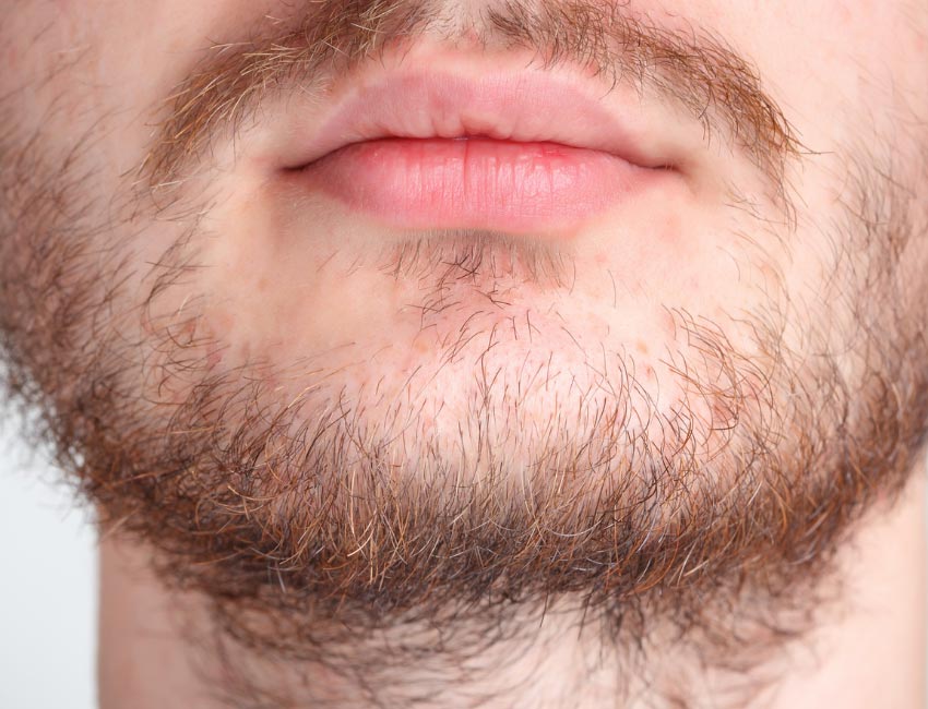 خواص روغن رزماری برای ریش