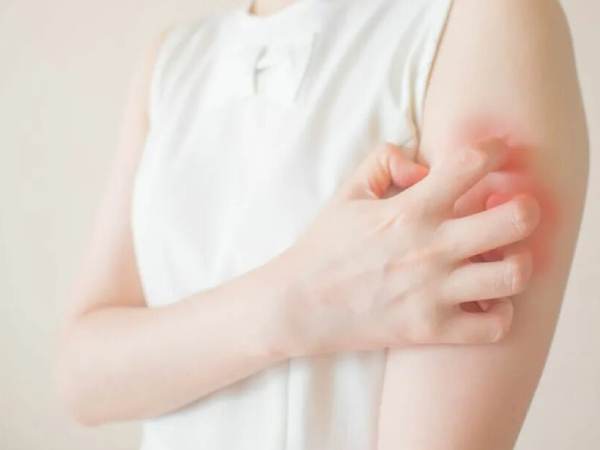 علت خارش بدن بعد از حمام