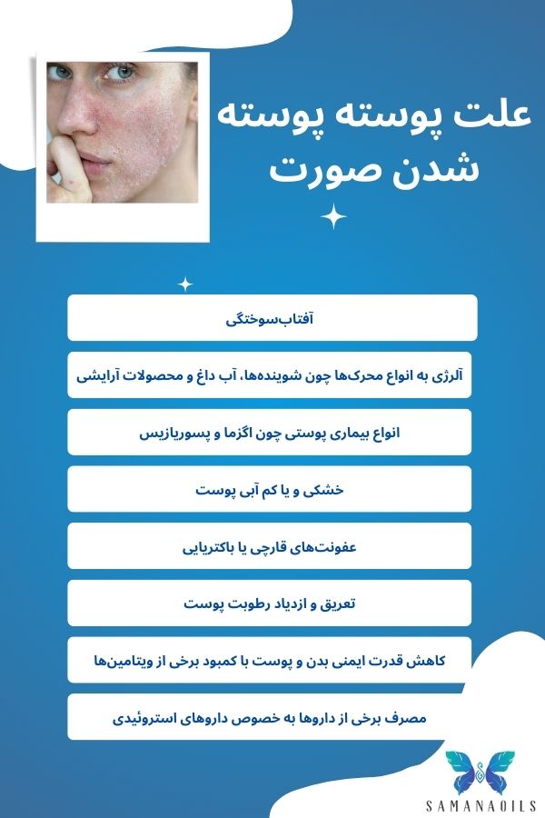 علت پوسته پوسته شدن صورت