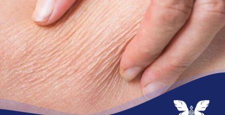 پوست دهیدراته