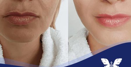 روغن مورینگا برای سفیدی پوست