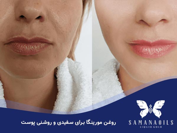 روغن مورینگا برای سفیدی پوست