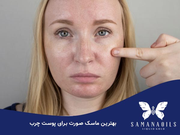 best mask for oily skin