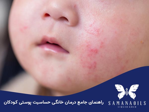 حساسیت پوستی کودکان