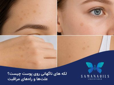 لکه های ناگهانی روی پوست