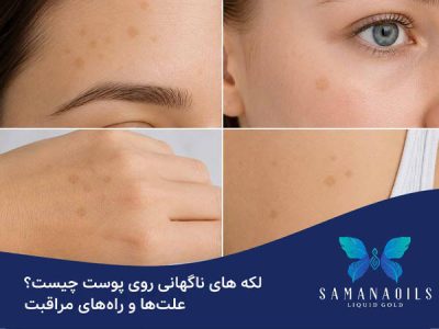 لکه های ناگهانی روی پوست