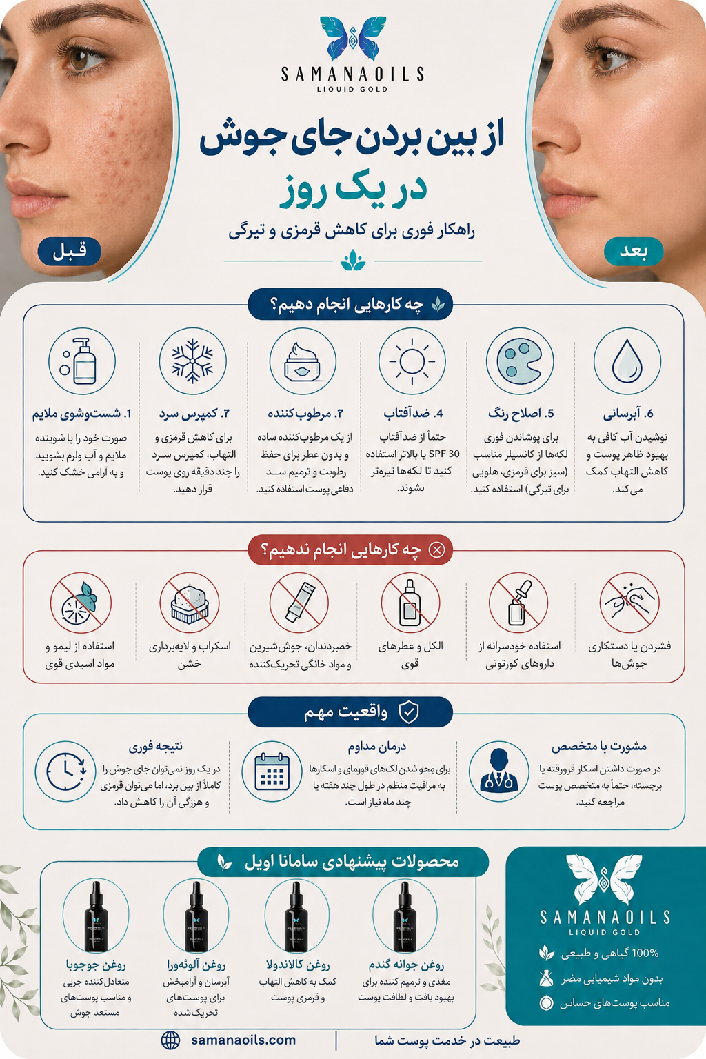 از بین بردن جای جوش